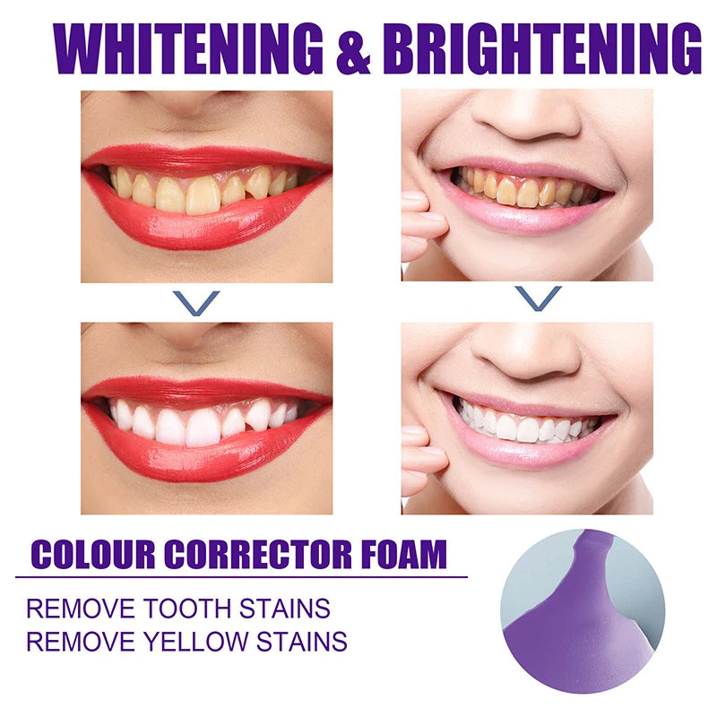 V34 50ml Mousse Toothpaste Teeth Cleaning Corrector Teeth Teeth Whitening Brightening Reduce Yellowing Cleaning Tooth Care